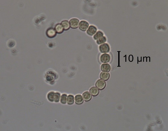 A photo of 10 um under the microscope.